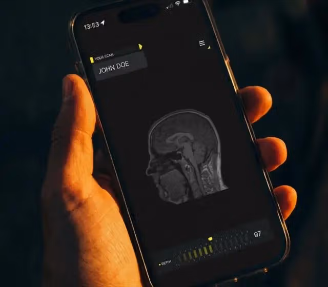A hand holding a phone showing a sagittal brain MRI scan in a dark-themed medical viewer app.