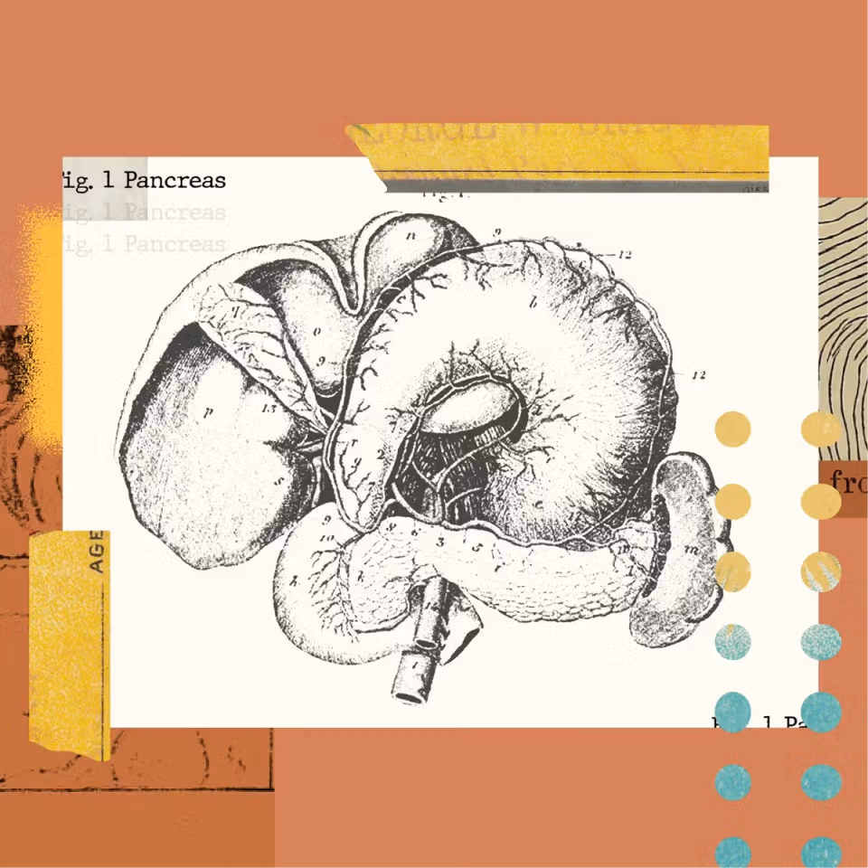Collage-style anatomical illustration of the pancreas on a warm-toned background.