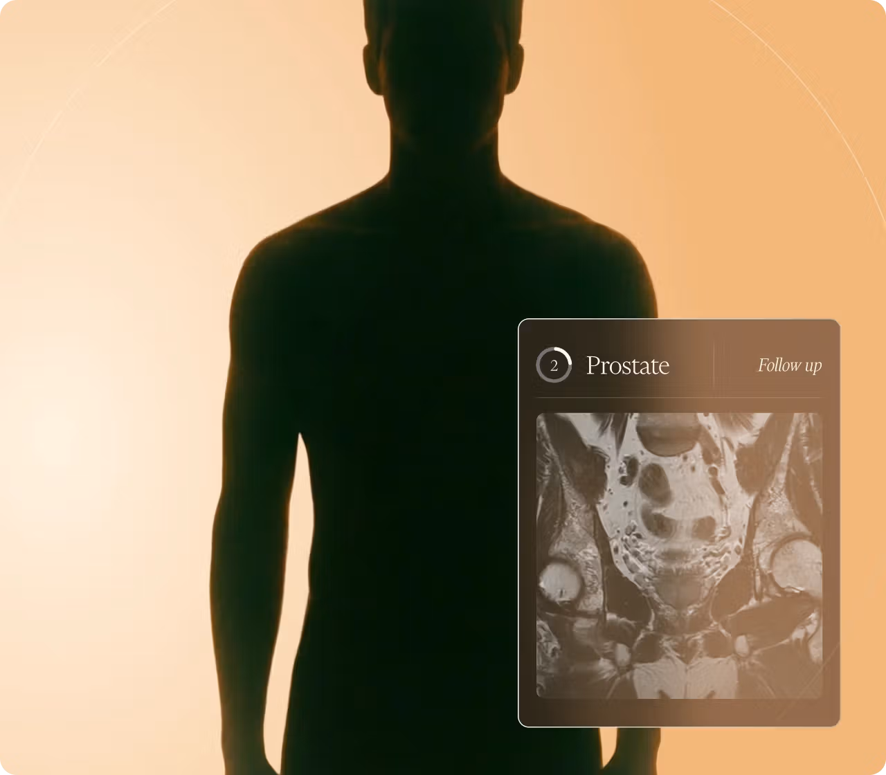 Male silhouette on a warm gradient background with an overlaid card displaying a prostate MRI and follow-up status.