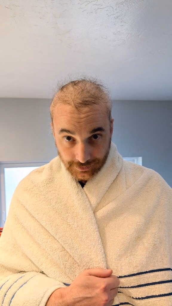 Mitchell wrapped in a towel during his cancer treatment journey.