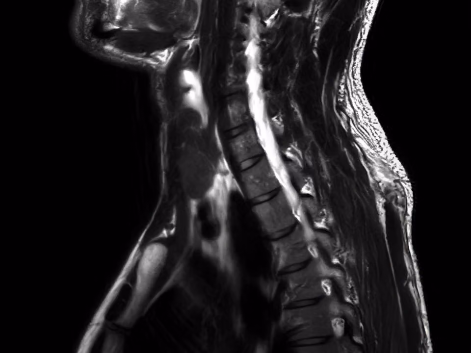 Placeholder — replace with MRI with Spine article hero image